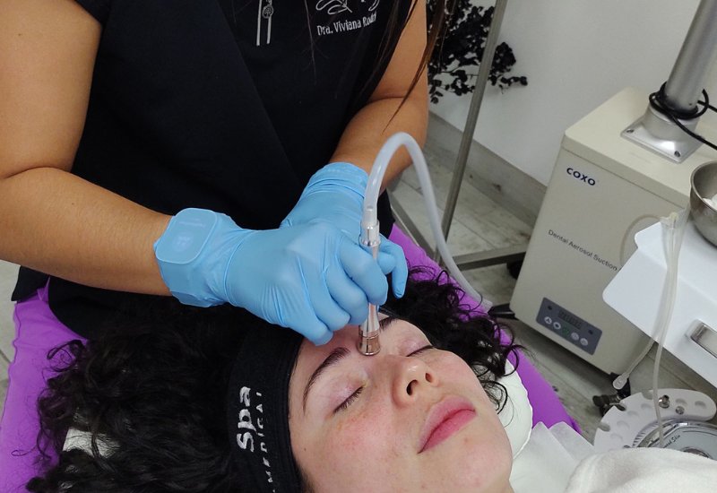 Hydrafacial en San José Costa Rica-1 Hydrafacial en San José Costa Rica-3