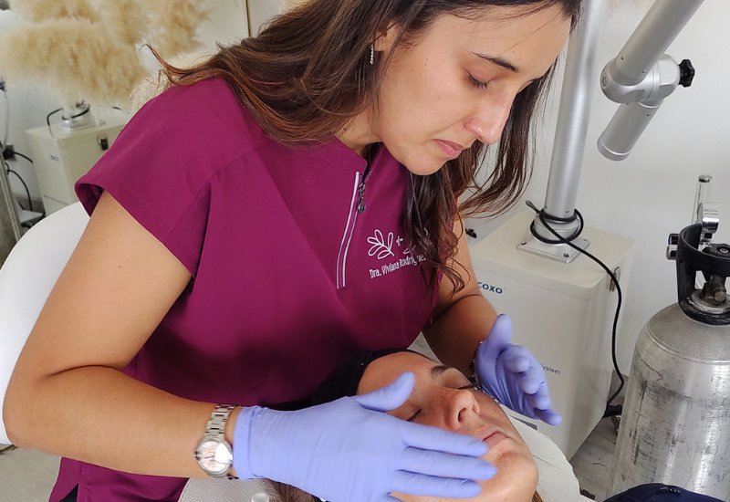 Peeling Facial en San José Costa Rica-2