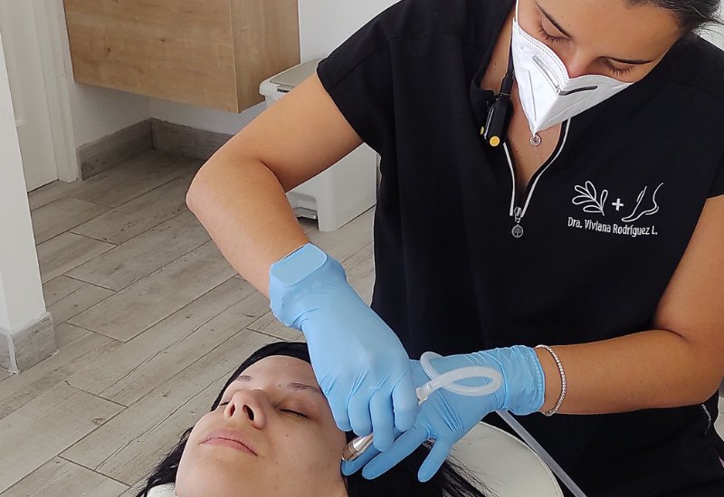 dermapen dermapen