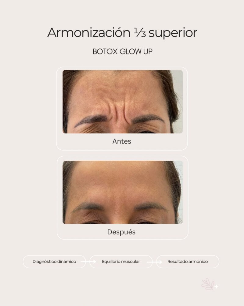 botox-spa-medical botox-spa-medical